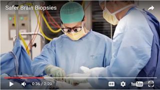 Needle helps brain surgeons see blood vessels 