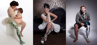 Bespoke prosthetics boost amputees self esteem and style